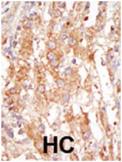 MAP3K6, Rabbit, Polyclonal Antibody, Abnova 400 &mu;L | Buy Online | Abnova Corporation | Fisher Scientific