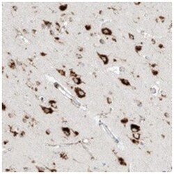 C2orf18, Rabbit, Polyclonal Antibody, Abnova 100 &mu;L | Buy Online | Abnova Corporation | Fisher Scientific