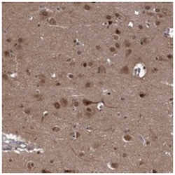 SYCP2L, Rabbit, Polyclonal Antibody, Abnova 100 &mu;L | Buy Online | Abnova Corporation | Fisher Scientific