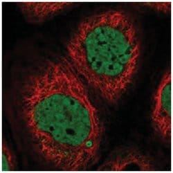 SYCP2L, Rabbit, Polyclonal Antibody, Abnova 100 &mu;L | Buy Online | Abnova Corporation | Fisher Scientific