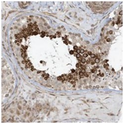 CHCHD4, Rabbit, Polyclonal Antibody, Abnova 100 &mu;L | Buy Online | Abnova Corporation | Fisher Scientific