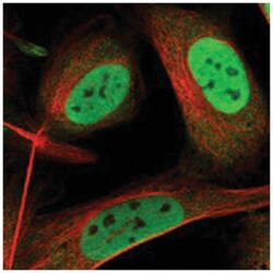 PPP4R2, Rabbit, Polyclonal Antibody, Abnova 100&mu;L; Unlabeled:Antibodies,