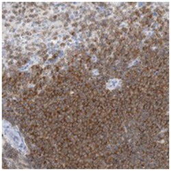 PSD4, Rabbit, Polyclonal Antibody, Abnova 100 &mu;L | Buy Online | Abnova Corporation | Fisher Scientific