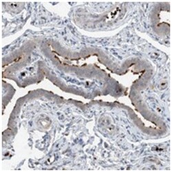 DNAH7, Rabbit, Polyclonal Antibody, Abnova 100&mu;L; Unlabeled:Antibodies,