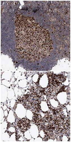 KIF4A Rabbit anti-Human, Polyclonal Antibody, Abnova 100&mu;L; Unlabeled:Antibodies,