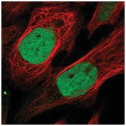 KIF4A Rabbit anti-Human, Polyclonal Antibody, Abnova 100&mu;L; Unlabeled:Antibodies,