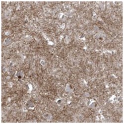BSN, Rabbit, Polyclonal Antibody, Abnova 100&mu;L; Unlabeled:Antibodies,