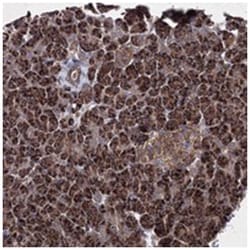 GFM1 Rabbit anti-Human, Polyclonal Antibody, Abnova 100 &mu;L | Buy Online | Abnova Corporation | Fisher Scientific