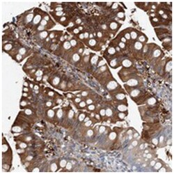 NCRNA00082, Rabbit, Polyclonal Antibody, Abnova 100&mu;L; Unlabeled:Antibodies,