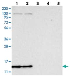 SF3B14 Rabbit anti-Human, Polyclonal Antibody, Abnova 100&mu;L; Unlabeled:Antibodies,