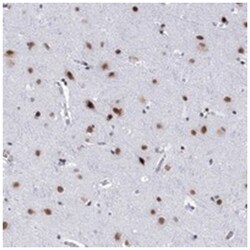 SF3B14 Rabbit anti-Human, Polyclonal Antibody, Abnova 100&mu;L; Unlabeled:Antibodies,