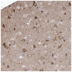 GTPBP8, Rabbit, Polyclonal Antibody, Abnova 100&mu;L; Unlabeled:Antibodies,