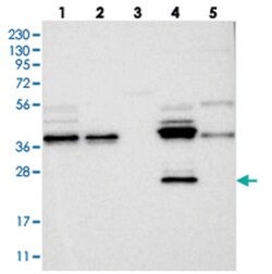 ZFAND6, Rabbit, Polyclonal Antibody, Abnova 100 &mu;L | Buy Online | Abnova | Fisher Scientific