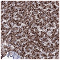 ZFAND6, Rabbit, Polyclonal Antibody, Abnova 100 &mu;L | Buy Online | Abnova | Fisher Scientific