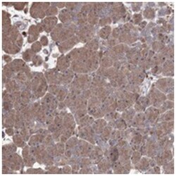 OPTC, Rabbit, Polyclonal Antibody, Abnova 100&mu;L; Unlabeled:Antibodies,