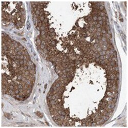 POL3S, Rabbit, Polyclonal Antibody, Abnova 100 &mu;L | Buy Online | Abnova Corporation | Fisher Scientific