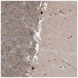 TNMD, Rabbit, Polyclonal Antibody, Abnova 100&mu;L; Unlabeled:Antibodies,