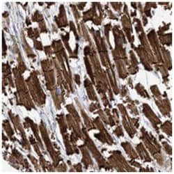 FAM26E, Rabbit, Polyclonal Antibody, Abnova 100&mu;L; Unlabeled:Antibodies,