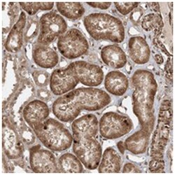 ETAA1, Rabbit, Polyclonal Antibody, Abnova 100&mu;L; Unlabeled:Antibodies,