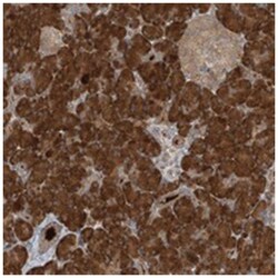 KIAA0556 Rabbit anti-Human, Polyclonal Antibody, Abnova 100 &mu;L | Buy Online | Abnova Corporation | Fisher Scientific