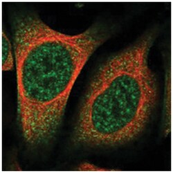 KIAA0556 Rabbit anti-Human, Polyclonal Antibody, Abnova 100 &mu;L | Buy Online | Abnova Corporation | Fisher Scientific