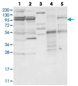 TBC1D5, Rabbit, Polyclonal Antibody, Abnova 100&mu;L; Unlabeled:Antibodies,