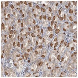 TBC1D5, Rabbit, Polyclonal Antibody, Abnova 100&mu;L; Unlabeled:Antibodies,
