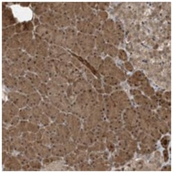 CATSPERB, Rabbit, Polyclonal Antibody, Abnova 100 &mu;L | Buy Online | Abnova Corporation | Fisher Scientific