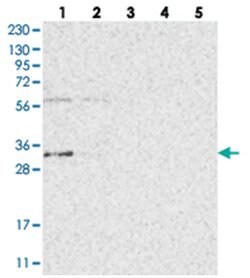ZFAND2B, Rabbit, Polyclonal Antibody, Abnova 100&mu;L; Unlabeled:Antibodies,
