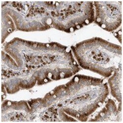 THADA, Rabbit, Polyclonal Antibody, Abnova 100 &mu;L | Buy Online | Abnova Corporation | Fisher Scientific