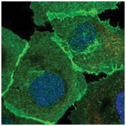 SLC1A5 Rabbit anti-Human, Polyclonal Antibody, Abnova 100&mu;L; Unlabeled:Antibodies,
