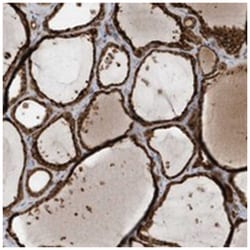 STX10, Rabbit, Polyclonal Antibody, Abnova 100 &mu;L | Buy Online | Abnova Corporation | Fisher Scientific