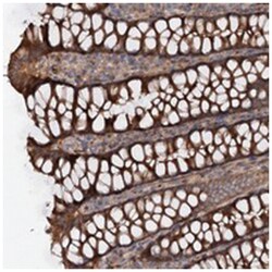 GPR112, Rabbit, Polyclonal Antibody, Abnova 100&mu;L; Unlabeled:Antibodies,