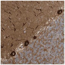 ECM2, Rabbit, Polyclonal Antibody, Abnova 100 &mu;L | Buy Online | Abnova Corporation | Fisher Scientific