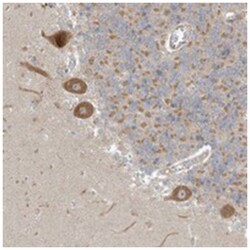 NPPC Rabbit anti-Human, Polyclonal Antibody, Abnova 100 &mu;L | Buy Online | Abnova Corporation | Fisher Scientific