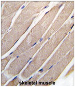 MAP2K4 Rabbit anti-Human, Polyclonal Antibody, Abnova 400&mu;L; Unlabeled:Antibodies,