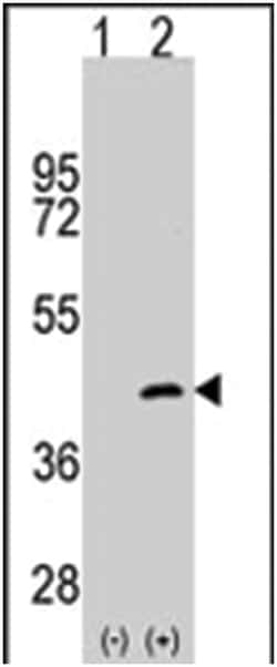 MAP2K4 Rabbit anti-Human, Polyclonal Antibody, Abnova 400&mu;L; Unlabeled:Antibodies,