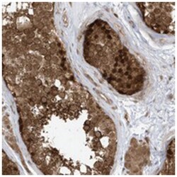 DHX36 Rabbit anti-Human, Polyclonal Antibody, Abnova 100 &mu;L | Buy Online | Abnova Corporation | Fisher Scientific