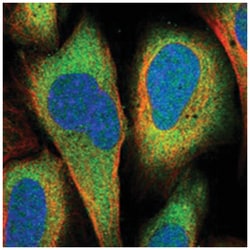 DHX36 Rabbit anti-Human, Polyclonal Antibody, Abnova 100 &mu;L | Buy Online | Abnova Corporation | Fisher Scientific