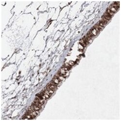SLC9B1, Rabbit, Polyclonal Antibody, Abnova 100 &mu;L | Buy Online | Abnova Corporation | Fisher Scientific