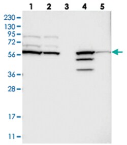 CERKL Rabbit anti-Human, Polyclonal Antibody, Abnova 100 &mu;L | Buy Online | Abnova Corporation | Fisher Scientific