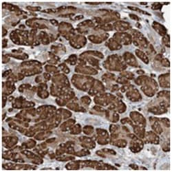 CERKL Rabbit anti-Human, Polyclonal Antibody, Abnova 100 &mu;L | Buy Online | Abnova Corporation | Fisher Scientific