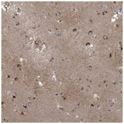 SFMBT2, Rabbit, Polyclonal Antibody, Abnova 100 &mu;L | Buy Online | Abnova Corporation | Fisher Scientific