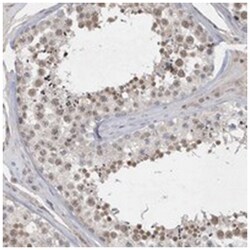 FAM217A, Rabbit, Polyclonal Antibody, Abnova 100 &mu;L | Buy Online | Abnova Corporation | Fisher Scientific