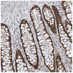 C6orf91, Rabbit, Polyclonal Antibody, Abnova 100 &mu;L | Buy Online | Abnova Corporation | Fisher Scientific