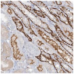 ATP11A Rabbit anti-Human, Polyclonal Antibody, Abnova 100 &mu;L | Buy Online | Abnova Corporation | Fisher Scientific