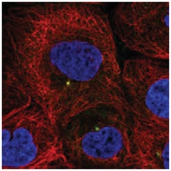 MAP7D3, Rabbit, Polyclonal Antibody, Abnova 100 &mu;L | Buy Online | Abnova Corporation | Fisher Scientific