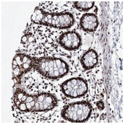 RBM16, Rabbit, Polyclonal Antibody, Abnova 100&mu;L; Unlabeled:Antibodies,