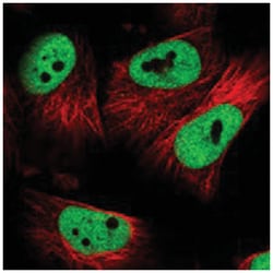 RBM16, Rabbit, Polyclonal Antibody, Abnova 100&mu;L; Unlabeled:Antibodies,