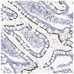 VILL, Rabbit, Polyclonal Antibody, Abnova 100&mu;L; Unlabeled:Antibodies,